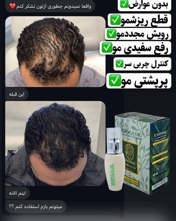 روغن مورینگا 50 میل اکسونیک|افزایش مو