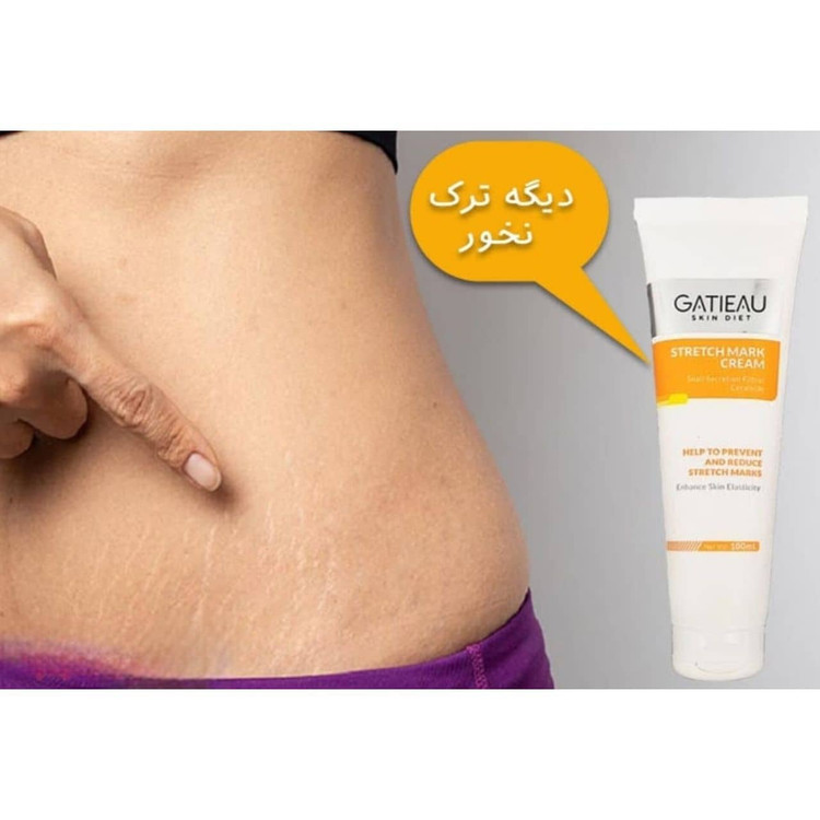 کرم استرچ مارک گاتیو |جلوگیری و رفع ترک های پوستی بعد از بارداری یا لاغری100ml